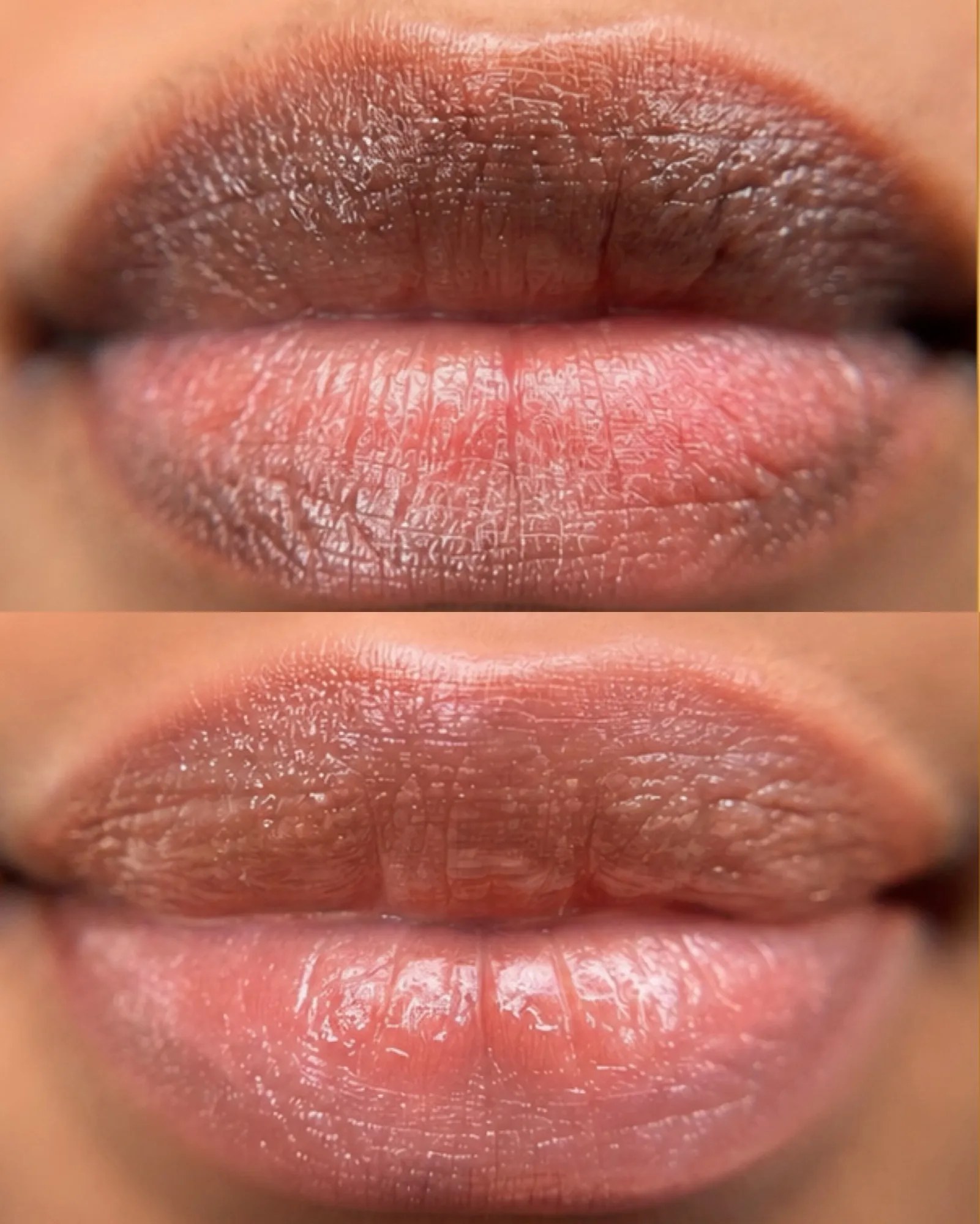 Dark lip neutralization before and after